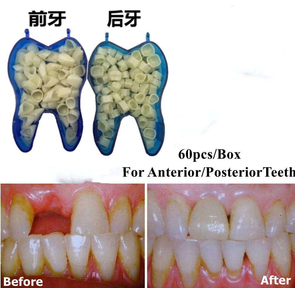 

60Pcs/Box Dental Resin Crowns Porcelain Temporary Crown Oral Teeth Whitening Covering Material Tool For Posterior Anterior Tooth