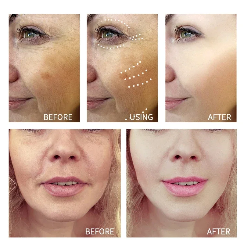 Retinolo Crema per la rimozione delle rughe Shot Rafforzamento Rassodante Linea sottile Enhancer Idratante Restringimento dei pori Riparazione Siero Set per la cura della pelle - immagine 2