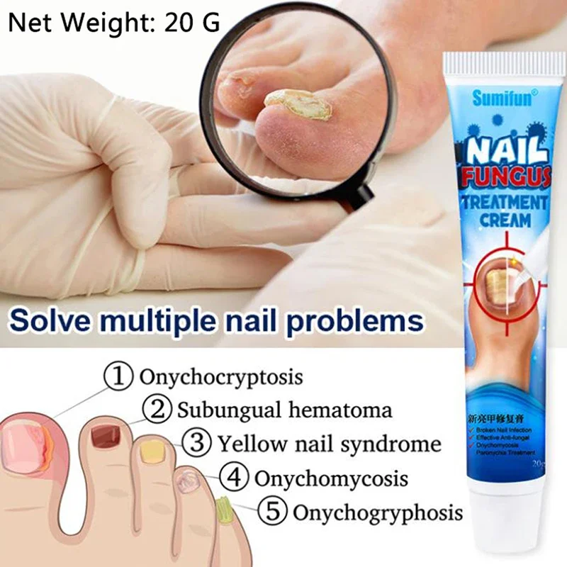 Nail Treatments Cream Nail Fungus Removal Ointment 20g 1Pcs