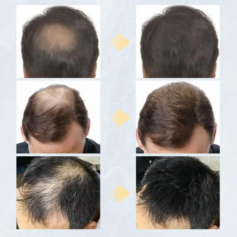 Hair Fibers Keratin Topic Thickening Spray Hair Building Fibers 27.5g Loss Products Instant Regrowth Powders Growth Product hair building powder hair building fibers hair growth spray