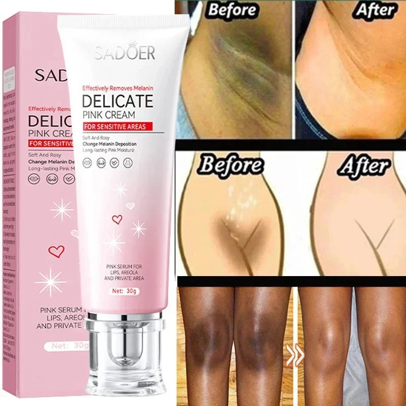 

Whitening Cream Private Parts Underarm Bleaching Serum Whiten Butt Knee Brighten Inner Thigh Intimate Parts Dark Remove Melanin