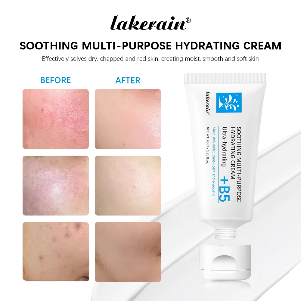 B5 Repair Cream Moisturizing Hydrating Solves Dry Chapped Red Skin Nourishes Improve Sunscreen Cream