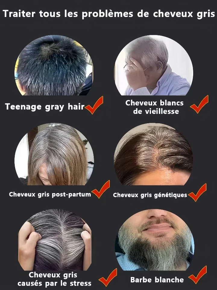White hair killer remove gray hair and restore natural color in 7 days