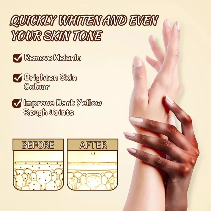 Dark Knuckles Fast Brighten Serum Elbows Hand Knuckle Brightening Serum Knee Black Skin Quickly Lighten Stains Remover Essence,facial serum,facial essence