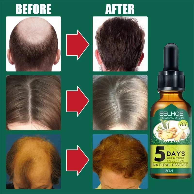 Natural Ginger Hair Care Essential Oil