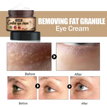 Fat Granules Remover Eye Cream Remove Dark Circles Eye Bags Fade Fine Lines Anti-Puffiness Wrinkles Lift Firming Eye Skin Care - Thumbnail 4