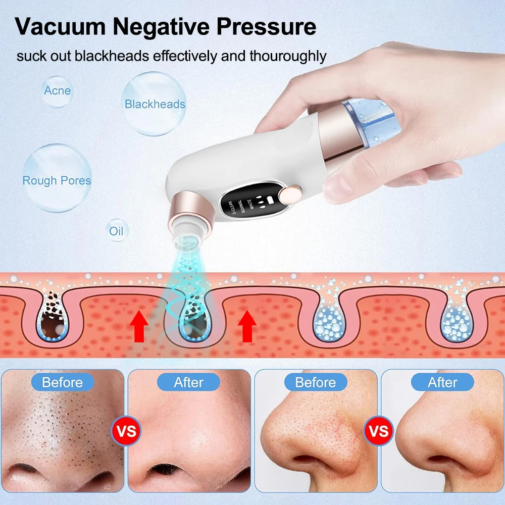 Electric Blackhead Remover Vacuum Facial Pore Cleaner Rechargeable Deep Dirt Skin Cleaning Machine for Pimple Blackhead Removal 2