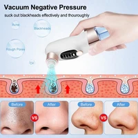 Electric Blackhead Remover Vacuum Facial Pore Cleaner Rechargeable Deep Dirt Skin Cleaning Machine for Pimple Blackhead Removal 2