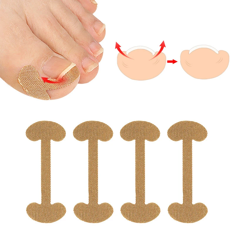 24Pcs=6Sheets Nail Correction Stickers Ingrown Toenail Corrector Patches Pedicure Paronychia Treatment Recover Protector