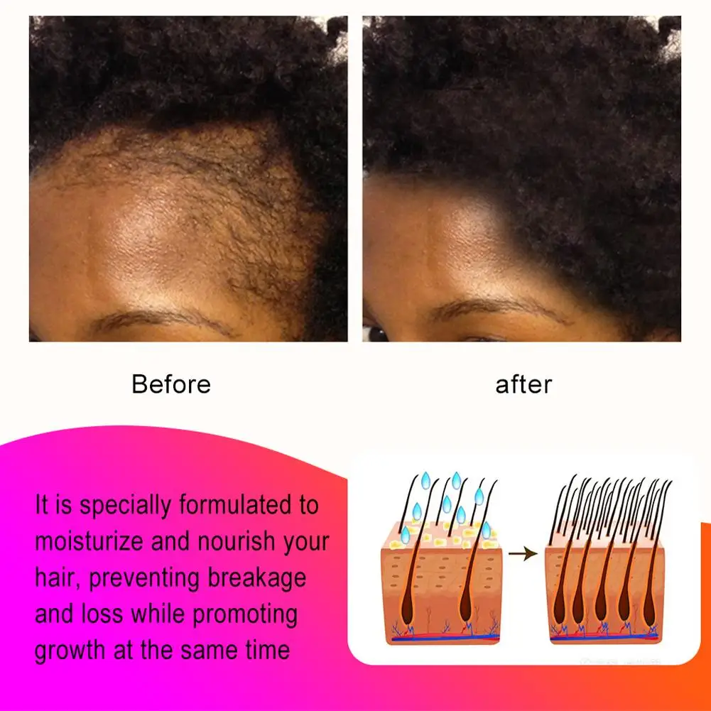 Natural Chad Chebe Powder Africa Super Fast Hair Modern Ingredient Hair Craftsmanship With Break Sevich Anti Regrowth