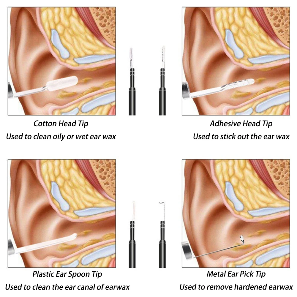 Appareil de nettoyage des oreilles intelligent, appareil médical pour  retirer le cérumen, appareil photo, cure-oreille