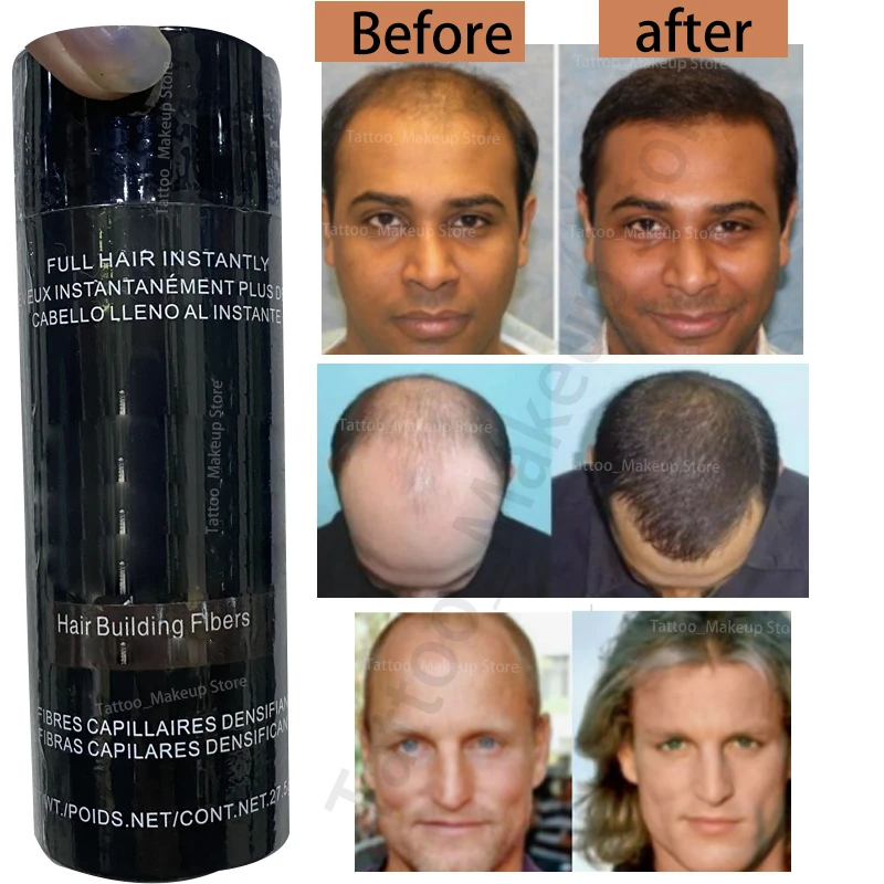 TIT  Keratin Hair Building Fibers Black Brown Hair Instantly Fibras  Capilares Fiber Hold Spray Powder Hair Treatment|Hair Loss Products| -  AliExpress