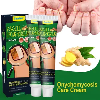 Nail Fungus Removal Cream Onychomycosis Fungal Nail Toe Infection Fungal Treatment Paronychia Ointment Care Nail Feet Anti L5X4