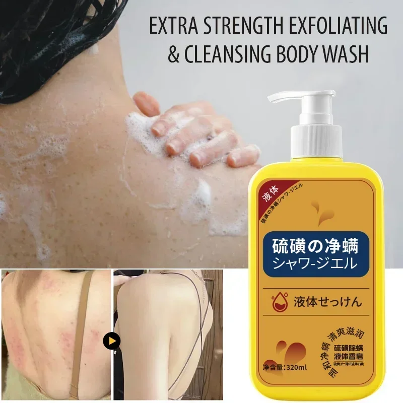 Body Wash 320ml Sulfur Liquid Mite Removal Soap Shower Gel Deep Cleansing Body Cleansers Whole Body Acne Wash