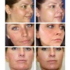 Kojic Acid Face Whitening Serum Glutathion Remove Blemish Dark Spot Correcting Glow Serum Face Skin Care Moisturizer Cosmetics 4