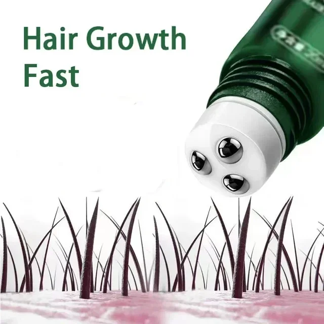 Hair Growth Oil Fast Growing Hair Effective Essential Baldness Repair Hereditary Anti Postpartum Seborrheic Hair Loss Products 2