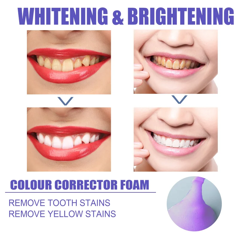 V34 Dental Care Products Purple Safe Teeth Whitening Toothpaste Teeth Cleaning Remove Yellow Stains Fresh Breath Toothpaste