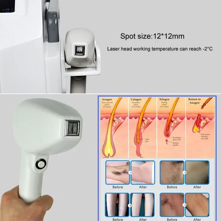 Рисунок 2 - Диодный лазер нм