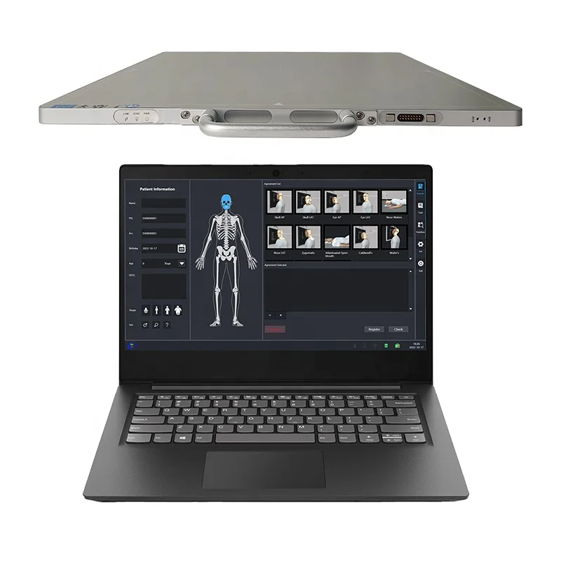 Рисунок 6 - Медицинский рентгеновский детектор с плоской панелью