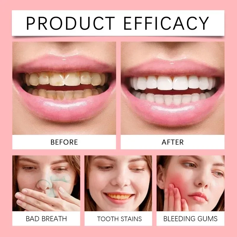 New SP-10 Probiotic Whitening Toothpaste Remove Plaque Stains Teeth Brightening Fresh Breath Toothpaste Oral Health Care 100g