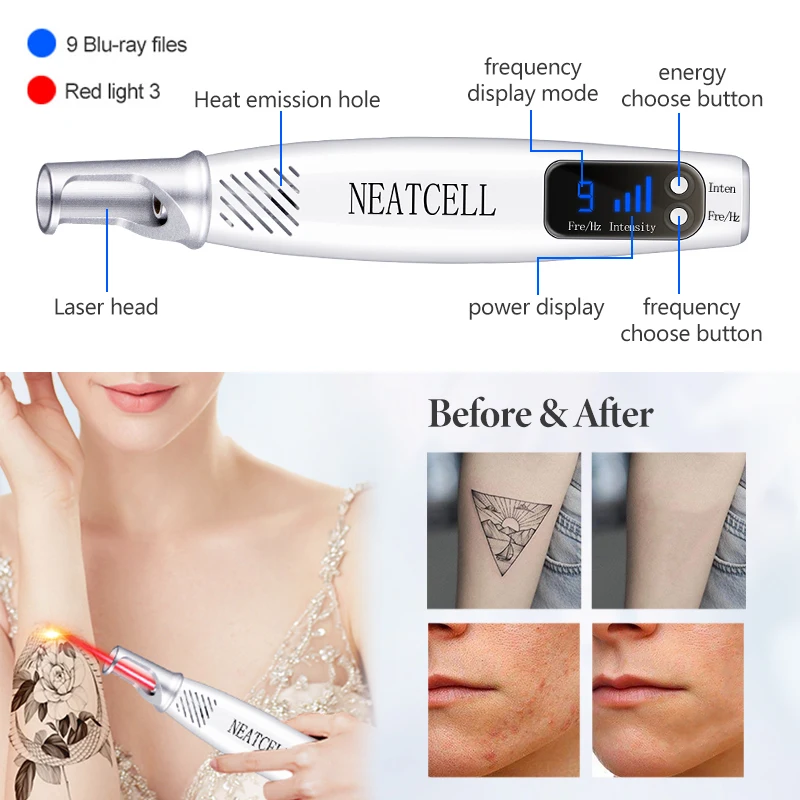 Picosecond Laser Pointer For Mole Dark Spot Pen Tattoo Acne Skin Pigment Portable Removal Machine Beauty Device_voghion.com