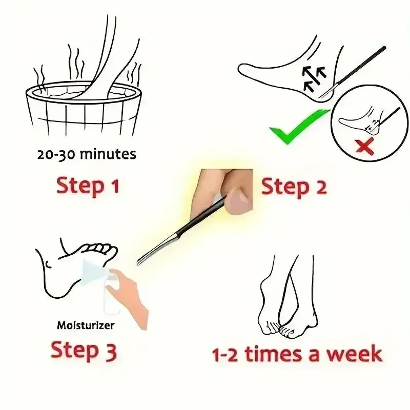 1Pc Pedicure Knife Tools Kits Professional Stainless Steel Foot Scrubber Dead Skin Remover Foot Scraper Knife Foot Care Tool New - 4