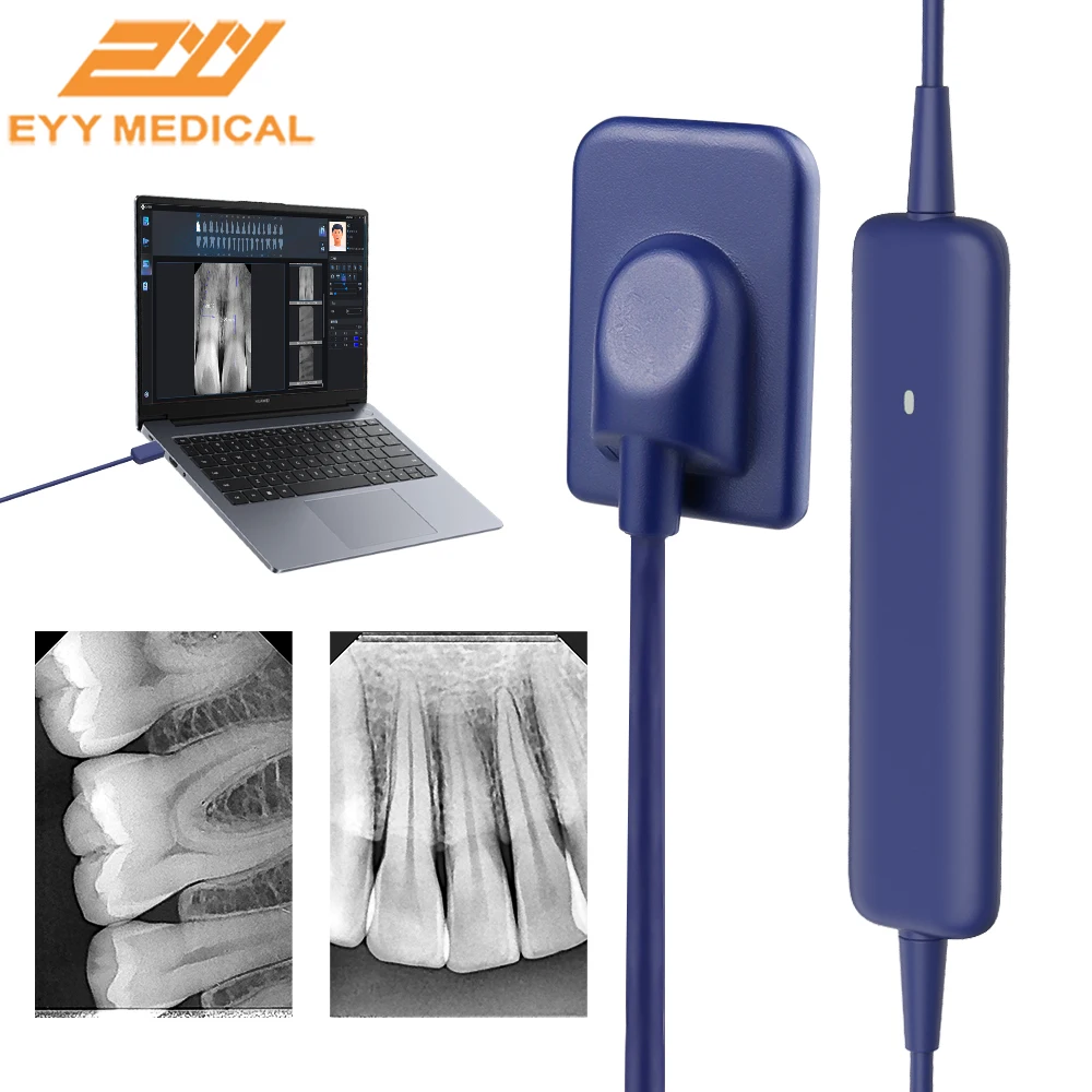 EYY Sensore a raggi X dentale Trasmissione rapida Scanner intraorale Sistema di imaging HD Sensore a raggi X DynImage digitale con software gratuito