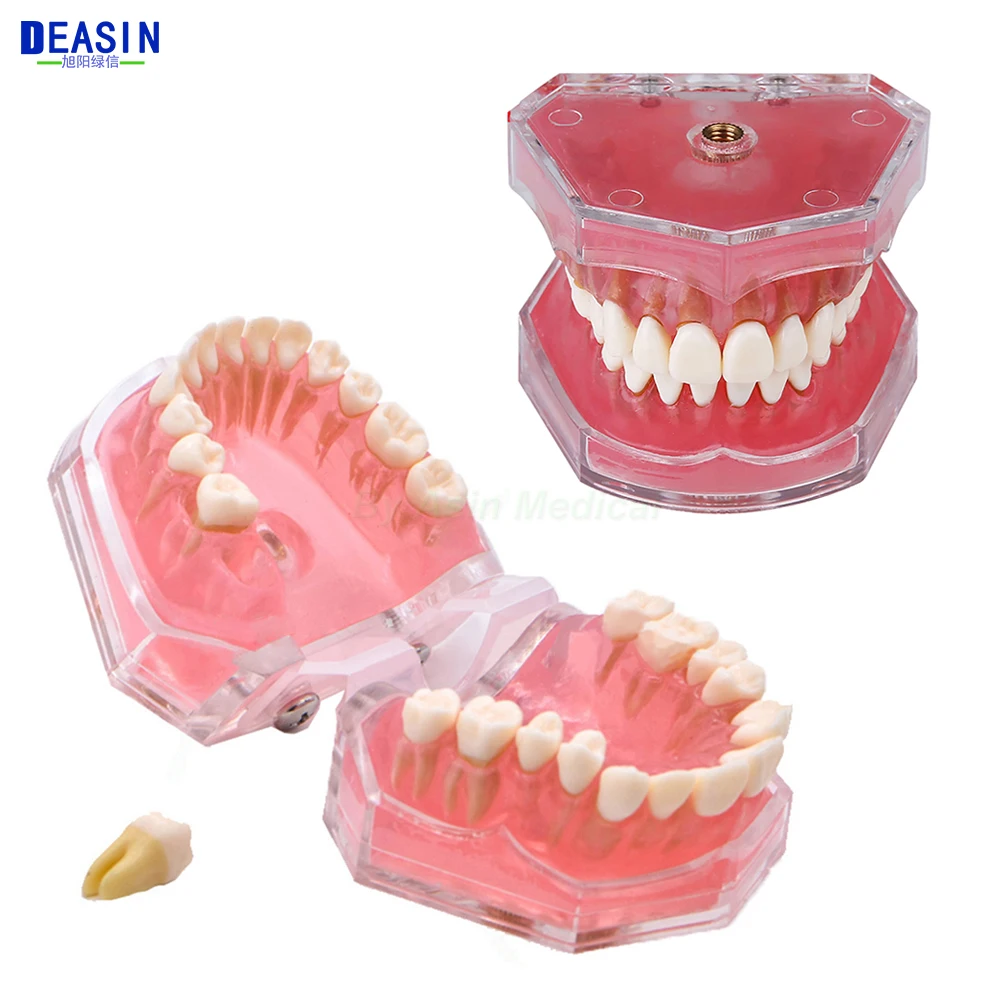 

Зубная модель зубная модель мягкая резинка взрослые зубы обучающая модель съемные зубы тренировочная экстракционная зубная модель