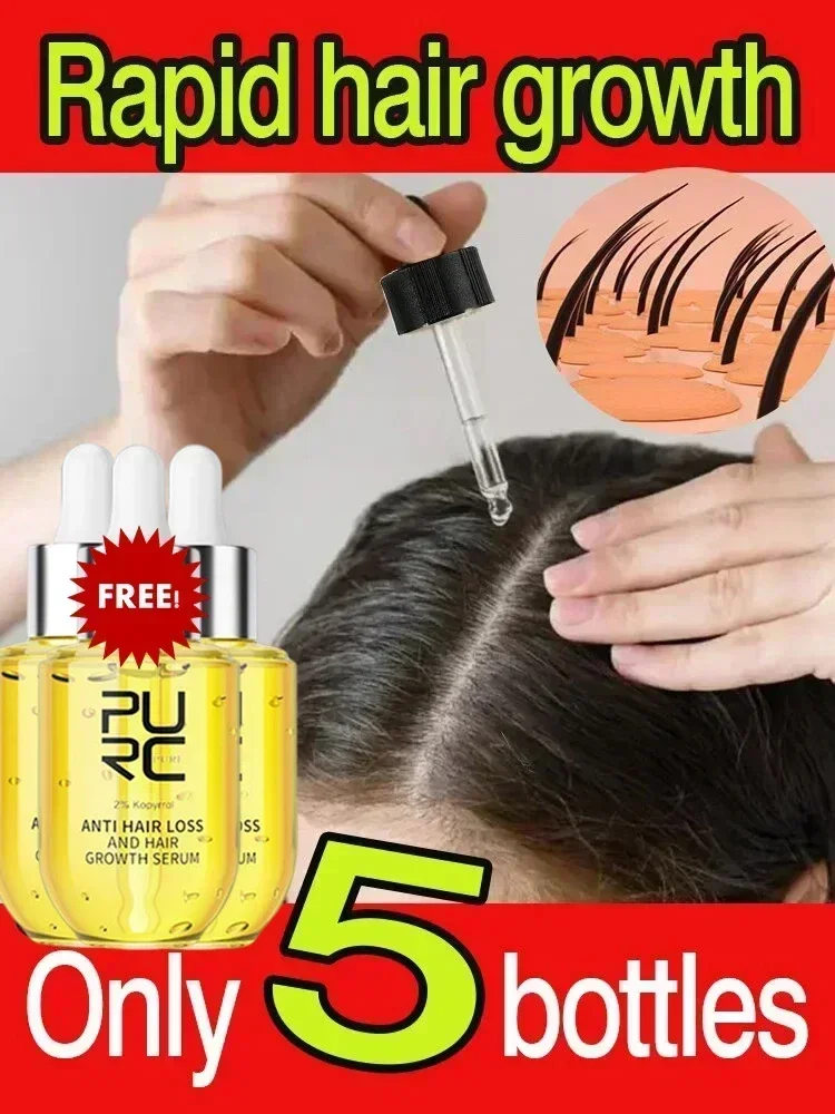 Ginger Hair Growth Oil Men Women Anti Loss Scalp Treatment Serum Beauty Health