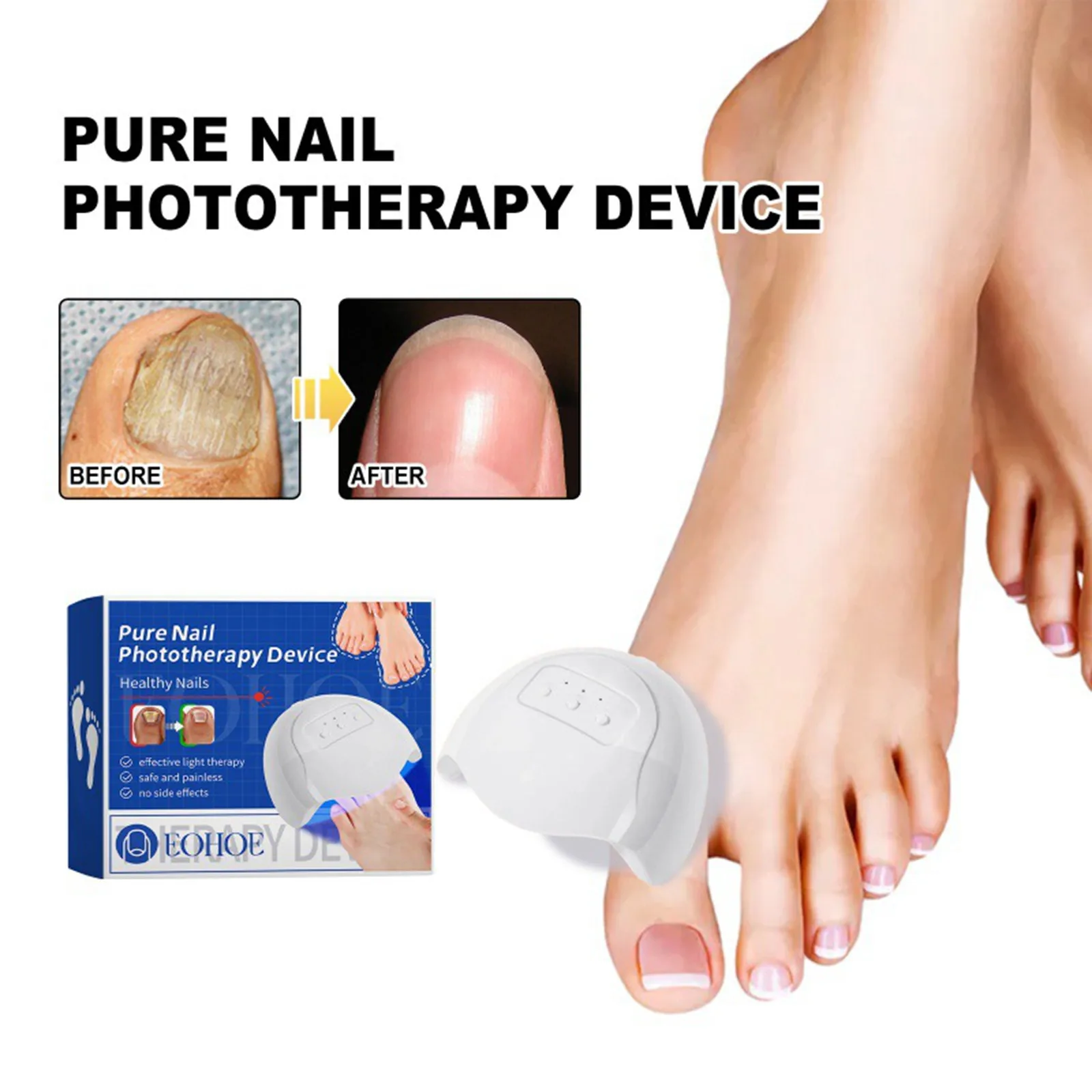 Fungal Nail Laser Device Repair Fast Nails Fungus Onychomycosis Repair Toenail Fingernail Removes Nail Fungus Foot Care Device nail fungus repair device