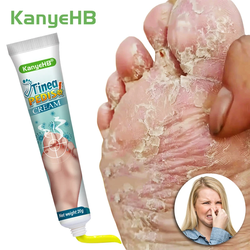Skin Care Ointment 1pcs Tinea Pedis Cream Remove Foot Odor Itchy Feet Athlete's Foot Anti-fungal Repair Erosive Skin Psoriasis