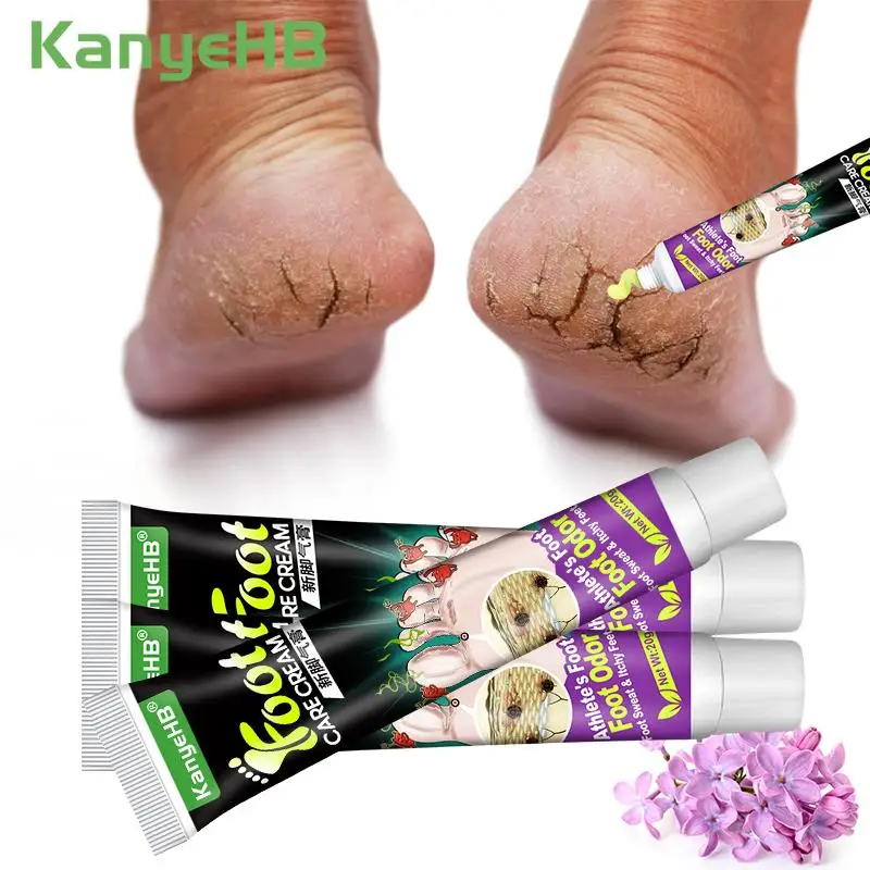 135pc Tinea Pedis Treatment Cream Curing Beriberi Foot Odor