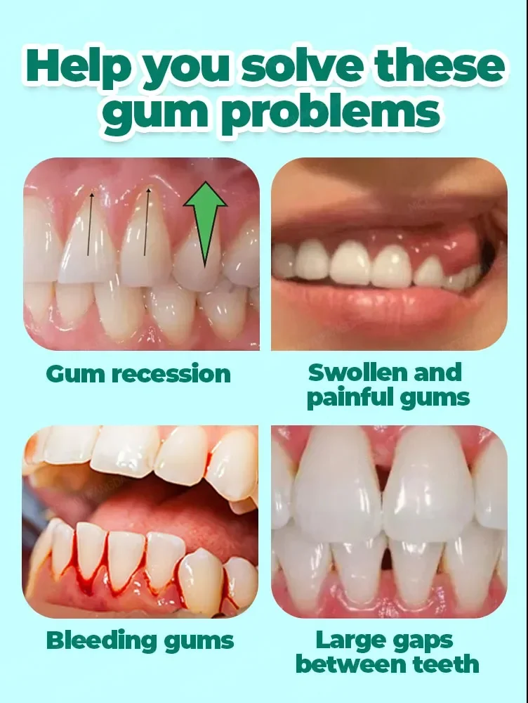 Repair Damaged Gum Problems Relieve Pain Strengthen Restore Dirty Gum Problems