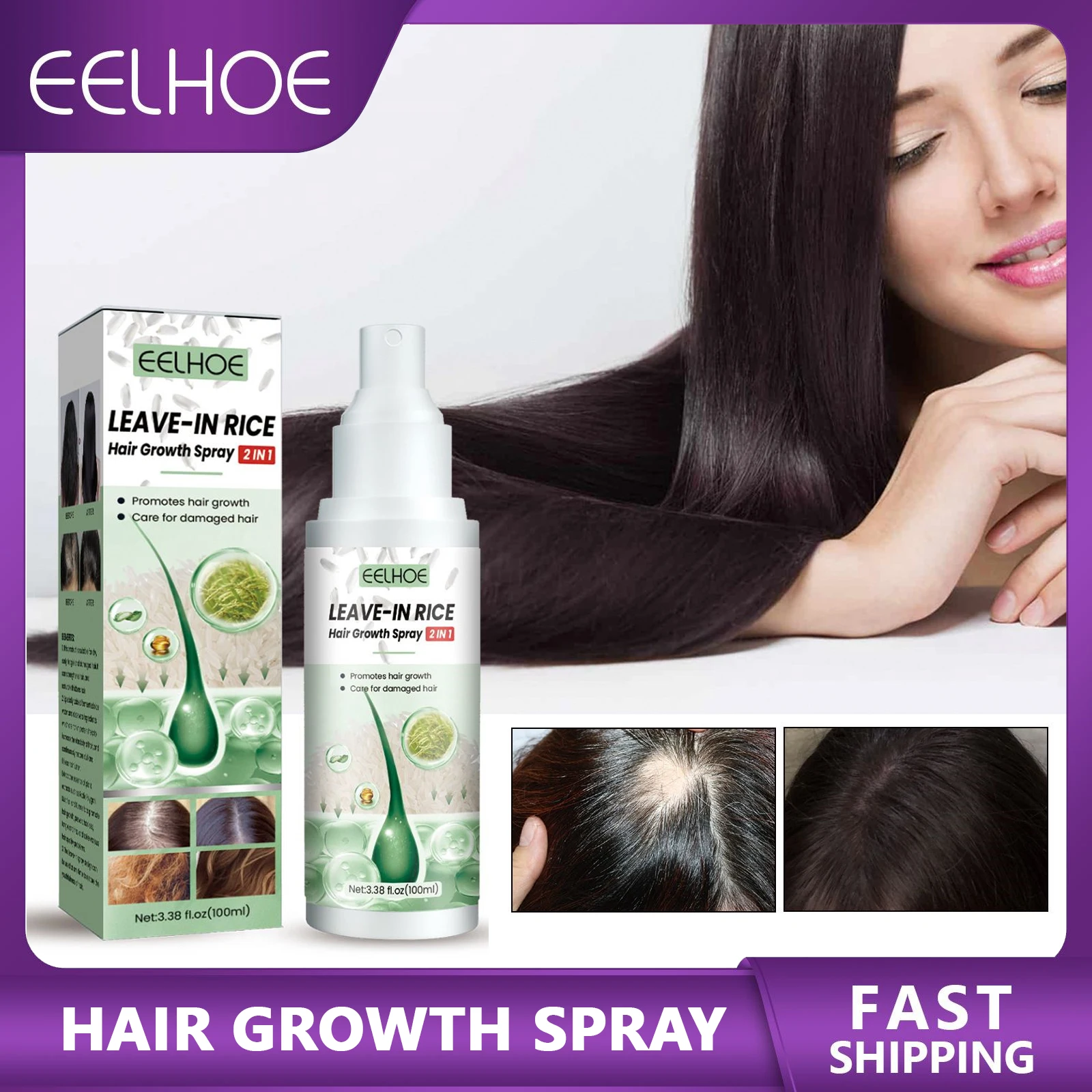 Leave-in Rice Hair Growth Spray Anti Hair Loss Dense Hair Roots Repair Damaged Hair Nourishing Moisturizing Scalp Treatment Care