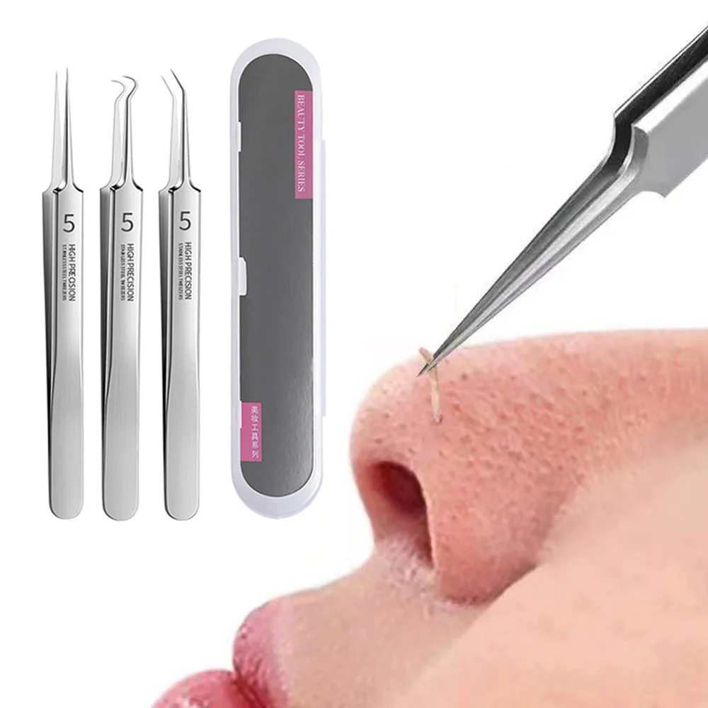 

3pcs/set Pimple Removal Tool Kit Stainless Steel Blackhead Extractor Facial Acne Blackheads Removal Clip Skin Care Beauty Tools