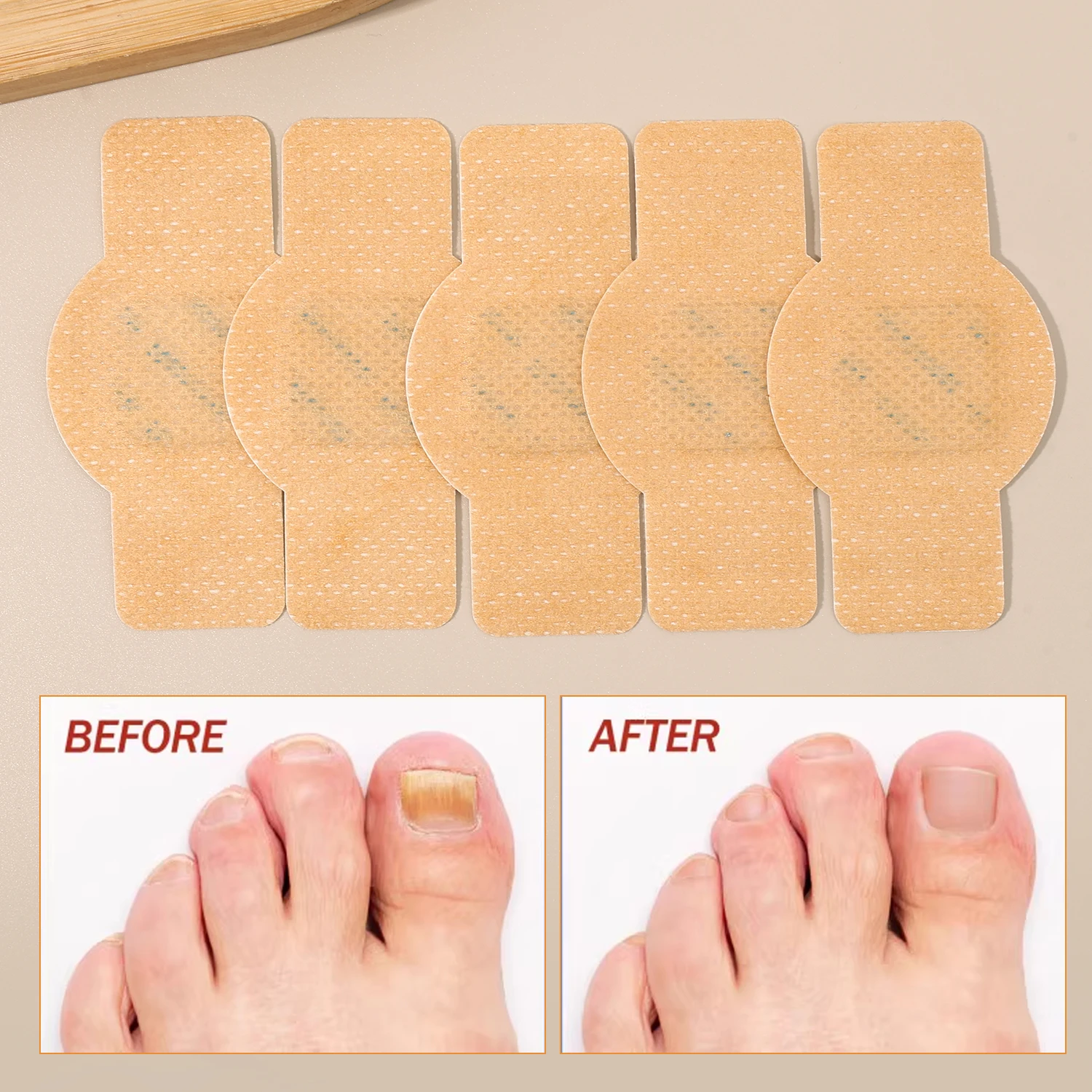 Ingrown Toenail Correction Patch Waterproof Nail Repair Tool Set_voghion.com
