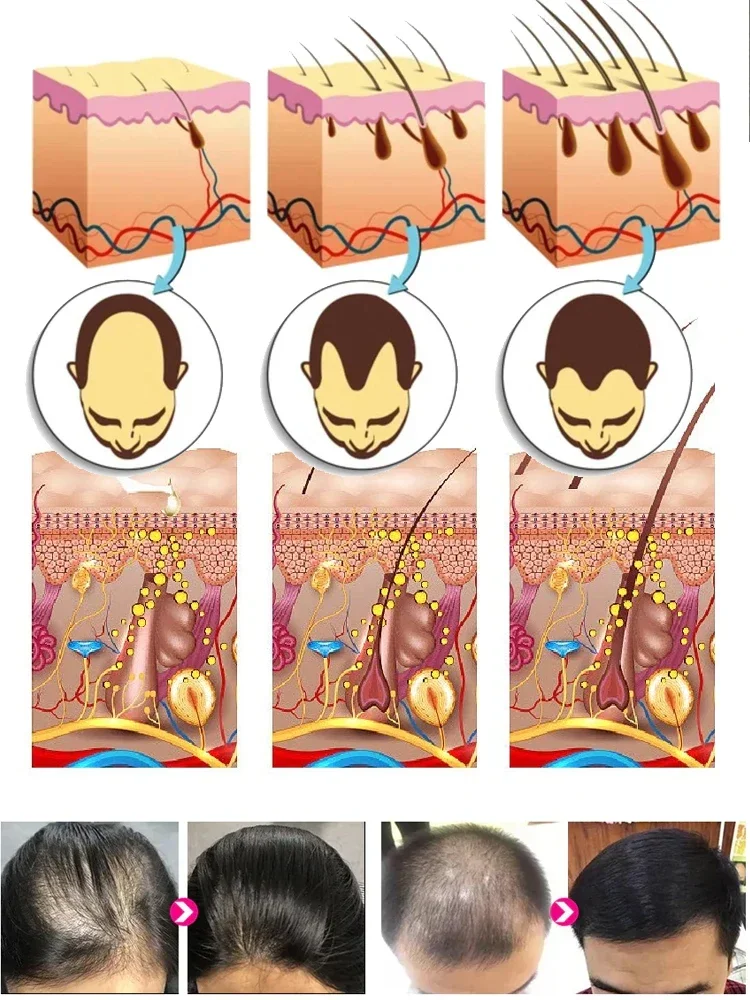 Hair Growth Oil Baldness Repair