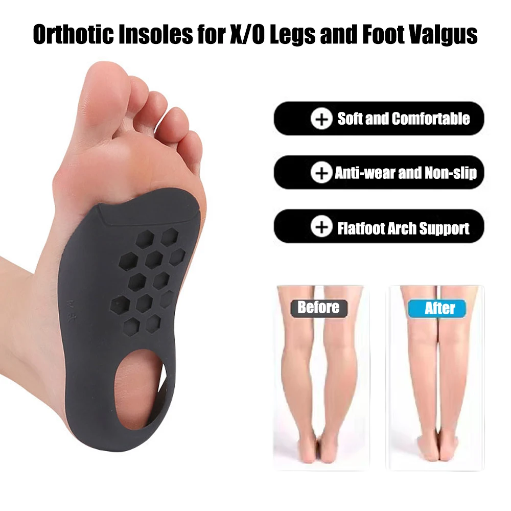 Orthesen-Einlegesohlen zur Korrektur von Xo-Beinen Ortho pä dische Einlegesohlen Plattfuß-Stütz kissen Planta rfasziitis Schmerz linderung Schuhe in lagen – Detail 4