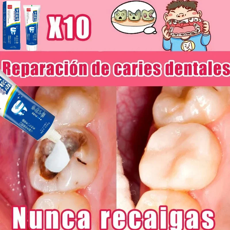 Quick Repair Cavities Caries Probiotic Toothpaste Clean Whiten Remove Yellow Plaque Protect Gum Reduce Tooth Stains Fresh Breath