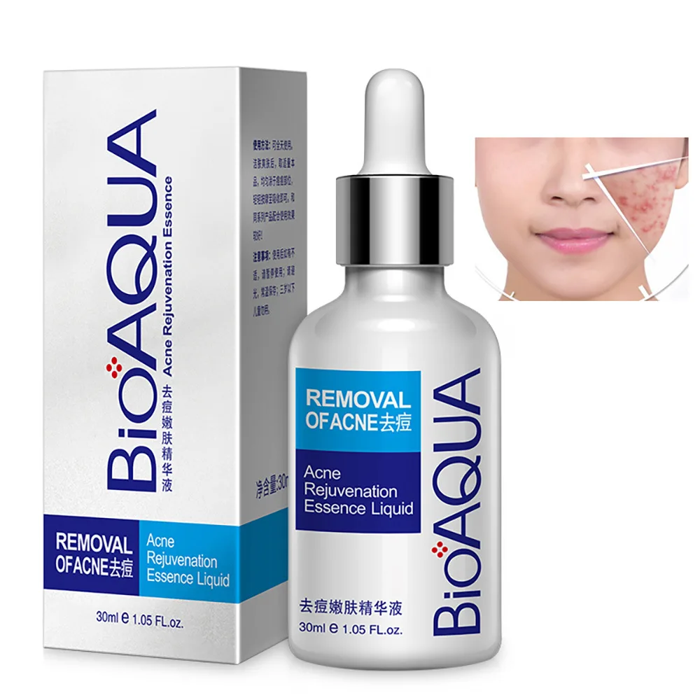 

BIOAQUA Brand 30ml Acne Treatment Essence Acne Scar Removal Liquid Acne Spots Facial Skin Care Whitening Moisturizing Face Care