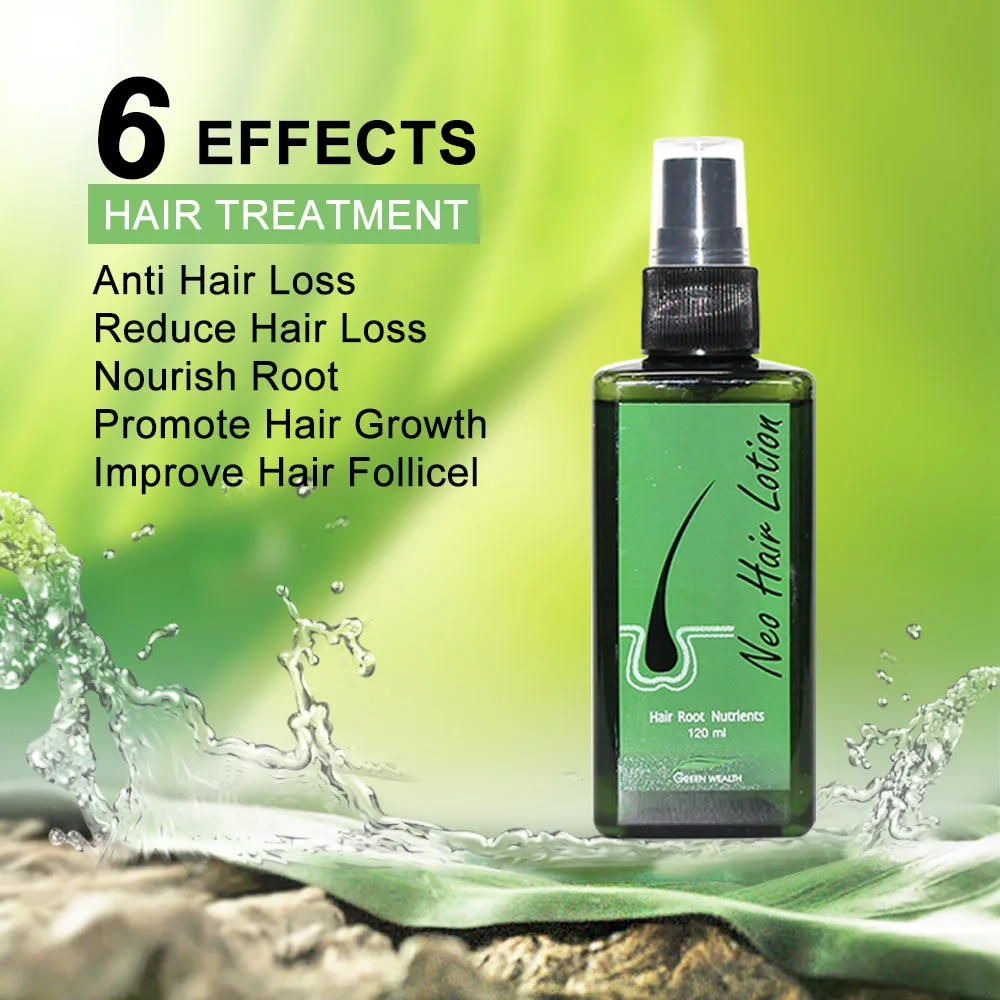 Neo Hair Lotion 120ml Hair Care Root Anti-Loss Beard Regrowth Original Thailand hair growth serum hair growth spray hair growth cream