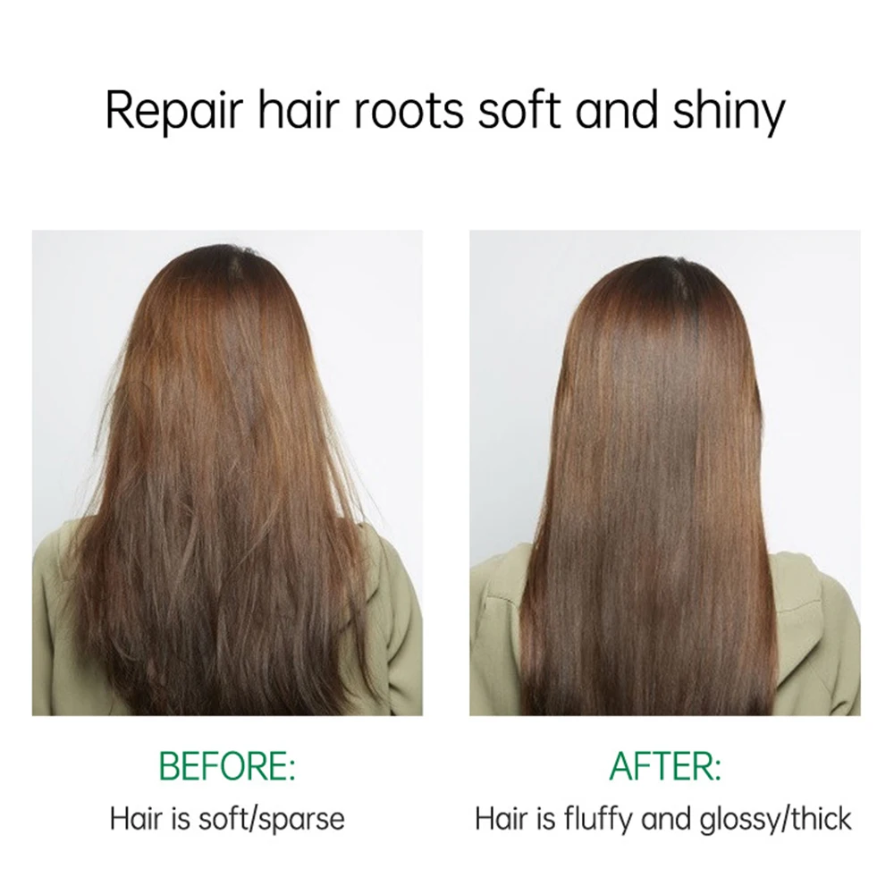 Рисунок 4 - Шампунь для роста волос против выпадения волос