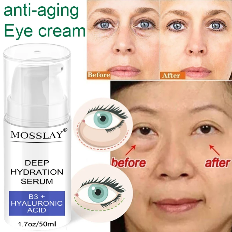 

MOSSLAY Anti Wrinkle Moisturizing Cream Whitening Cream Moisturizing Whitening Anti-aging Removing Dark Line