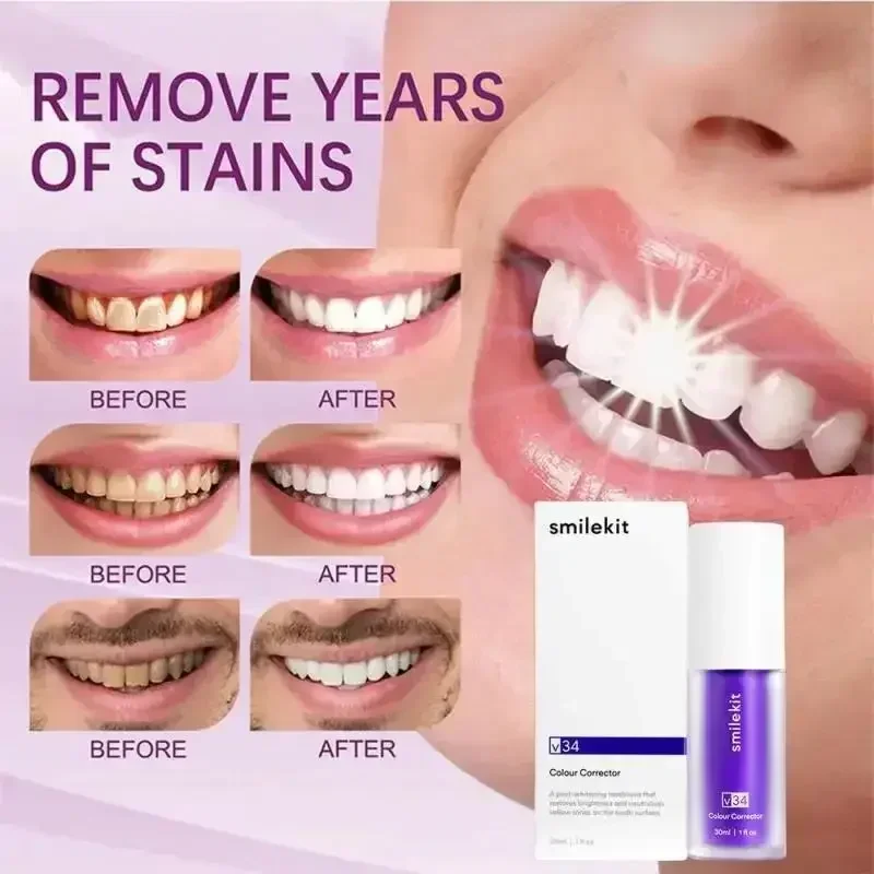 SMILEKIT V34 Whitening Toothpaste Remove Smoke Stain Remove Stains Reduce Yellowing Care For Teeth Gums Fresh Breath