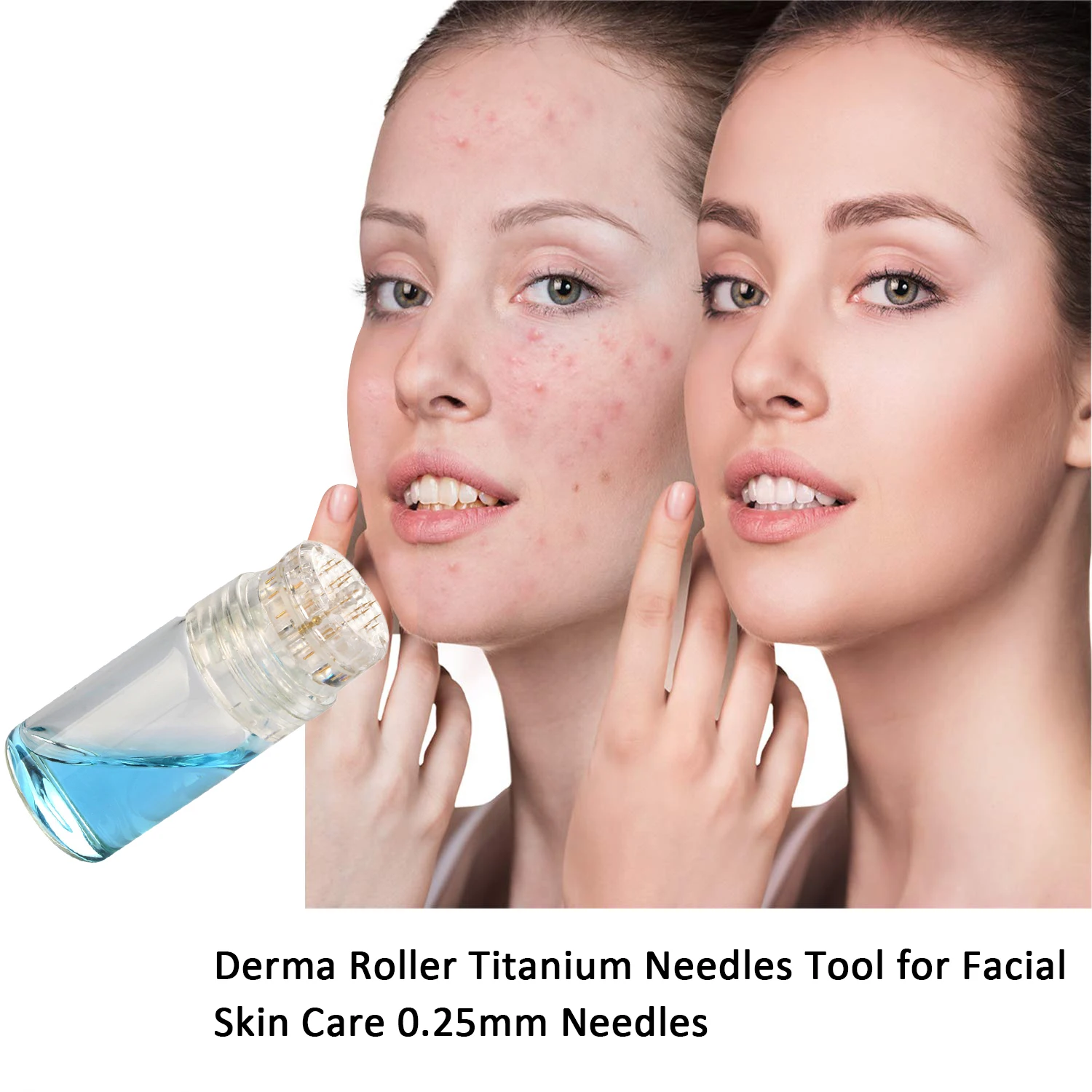 Hydra Needle Titanium needle Tool and Serum Applicator - Cosmetic Derma Roller Tool For Face,Beard Growth- 0.2mm/0.25mm/0.3mm