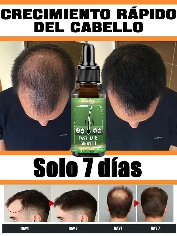 Hair Treatment Hot selling product, 99% of buyers buy again, have more and more hair, say goodbye to baldness, thick hair