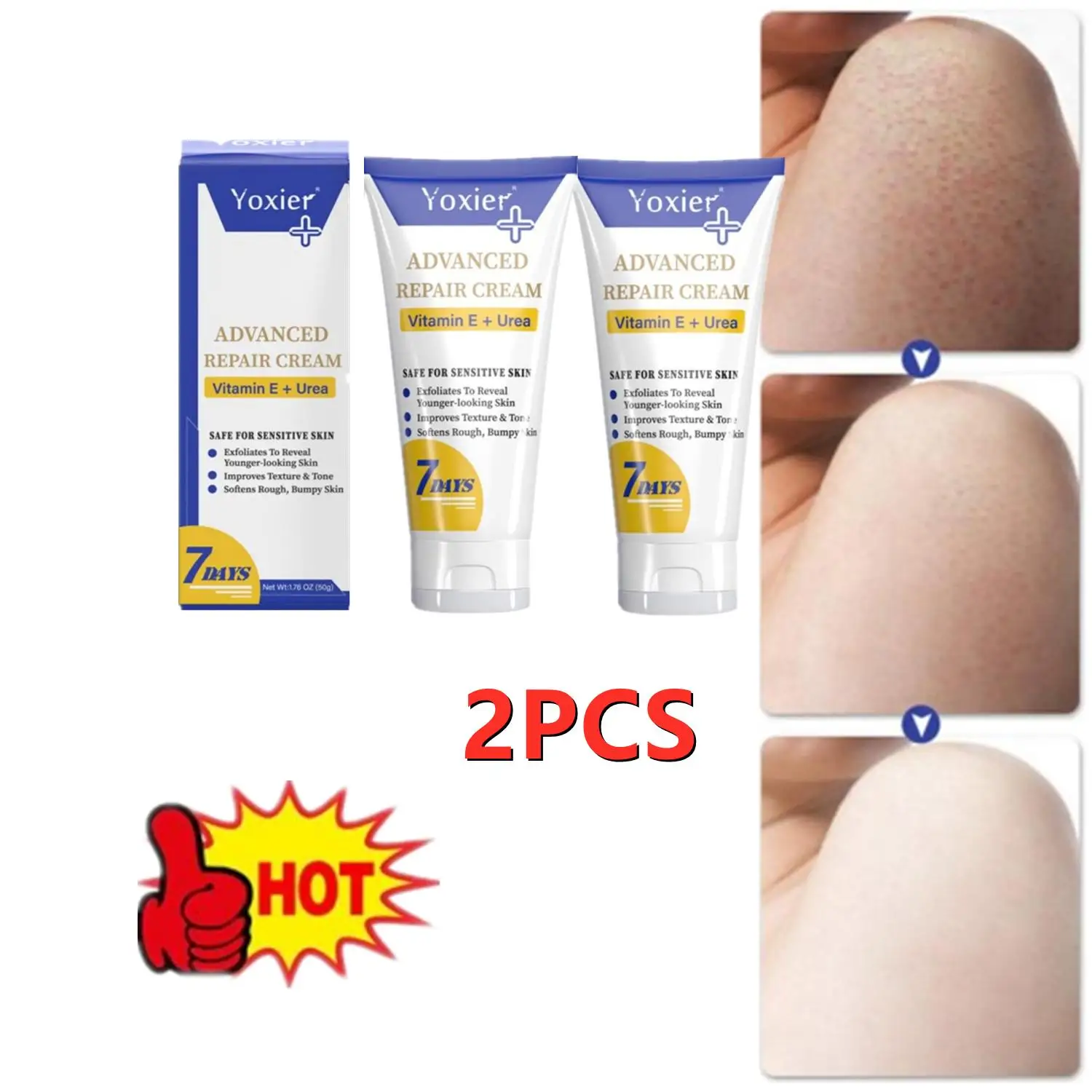 2PCS 7Days Moisturizing BodyCream Treatment Keratosis Pilaris Improves E Bumpy Rough Whitening Texture Skin Softens Vitamin Tone