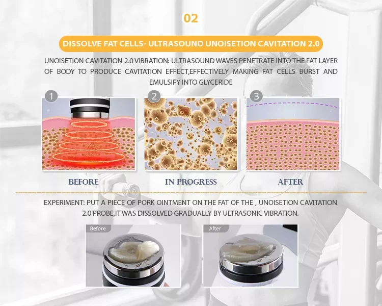 Unoisetion Cavitation 痩身キャビテーション