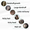 Selenium Disulfide Shampoo Oil Control Refreshing Anti-itch Scalp Cleansing Shampoo Nourishing and Smoothing Shampoo 230ml 5