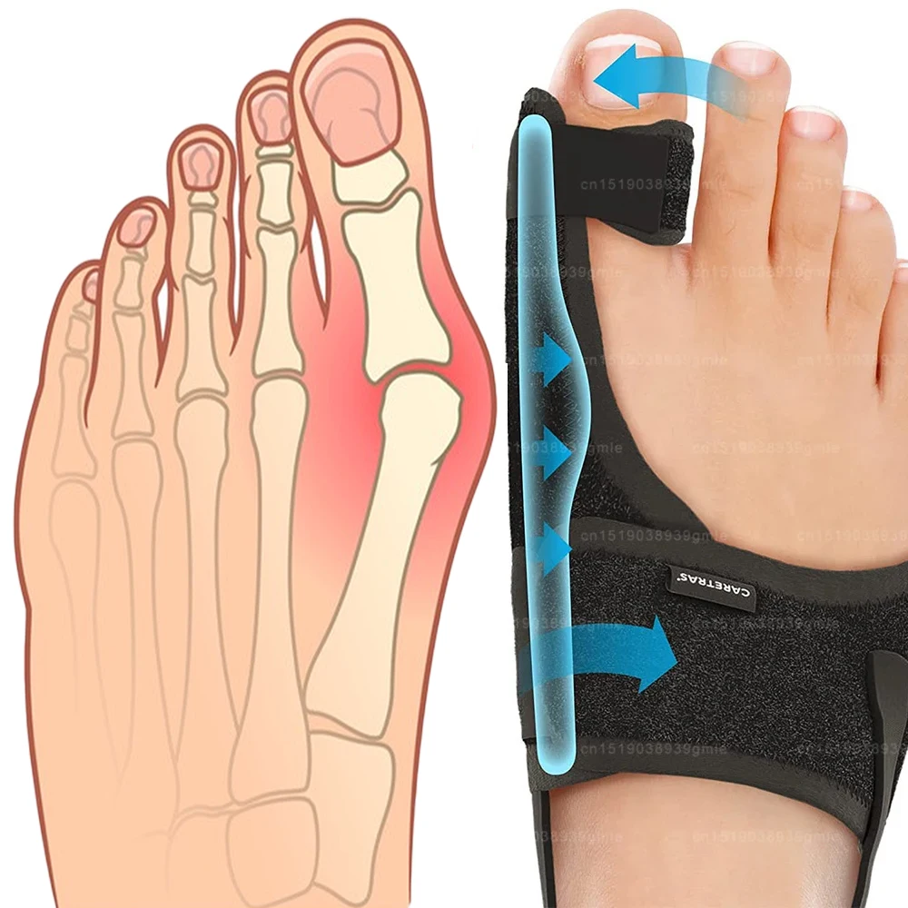 Thumb Valgus Corrector Orthopedic Bunion Splint Corrector Big Toe Separator Pain Relief Pedicure Bunion Protector Toes Bigfoot